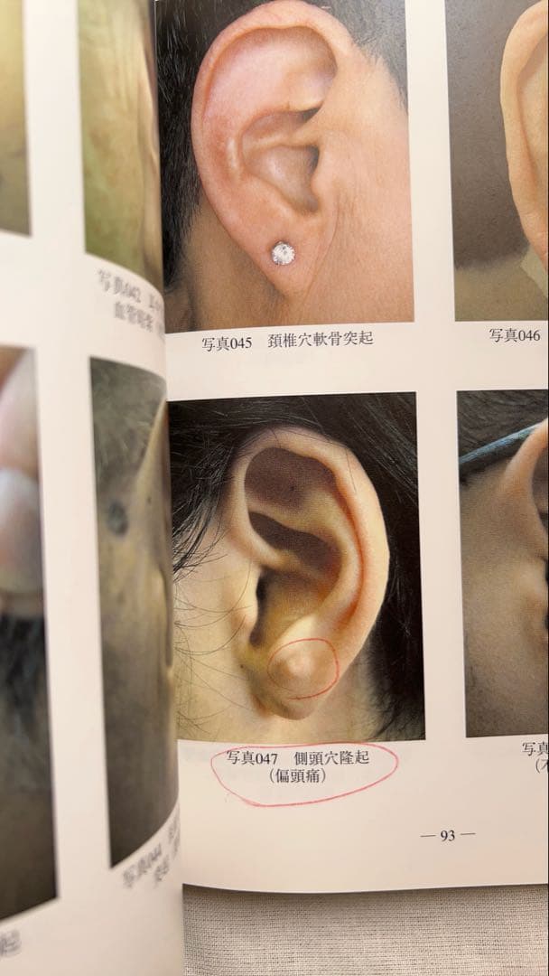 耳穴診療法　陳　志強